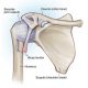 آسیب کپسول مفصلی یا لقی سر شانه - ورزش درمانی